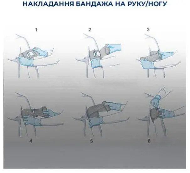 Израильский компрессионный кровоостанавливающий бандаж 15 см (6 дюймов) с одной подушечкой версия PRO арт.168 фото